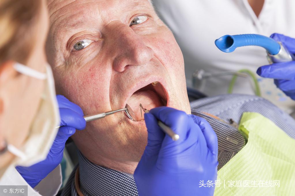 怎么可以去除牙结石-自己去除牙结石最有效的方法
